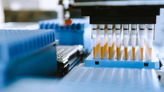 HPLC